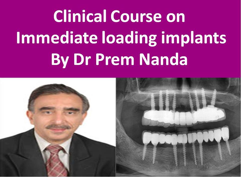  3 days Clinical course on Immediate loading (with Basal Implant and Syncrystallization) By Dr Prem nanda